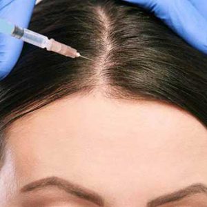 مزوتراپی مو در سقز