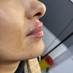 ژل لب روسی در سقز لب روسی سقز