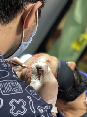 کاشت مو دکتر لطفی یار